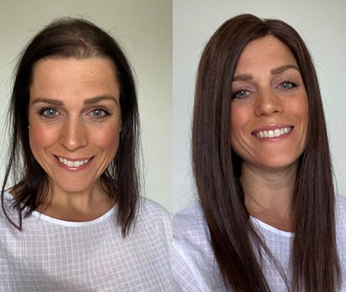 Before & After 8